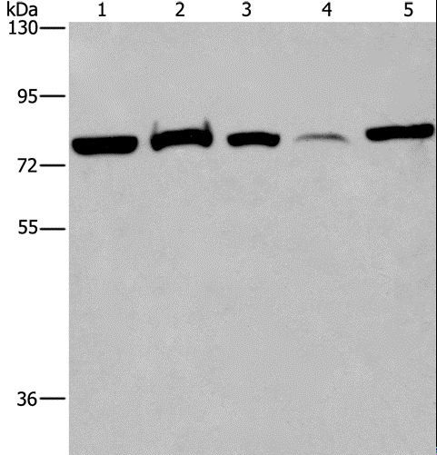 ACVR2 / ACVR2A Antibody - Western blot analysis of 293T cell, human fetal brain tissue and K562 cell, human fetal liver tissue and HeLa cell, using ACVR2A Polyclonal Antibody at dilution of 1:400.