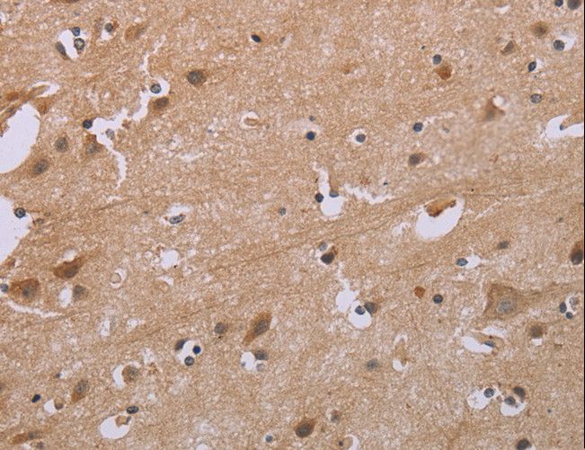ACVR2 / ACVR2A Antibody - Immunohistochemistry of paraffin-embedded Human brain using ACVR2A Polyclonal Antibody at dilution of 1:20.