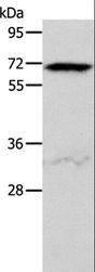ACVR2 / ACVR2A Antibody - Western blot analysis of HeLa cell, using ACVR2A Polyclonal Antibody at dilution of 1:400.