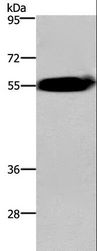 ACVR2 / ACVR2A Antibody - Western blot analysis of Human fetal brain tissue, using ACVR2A Polyclonal Antibody at dilution of 1:400.