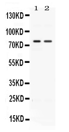ACVR2 / ACVR2A Antibody - Western blot - Anti-ACVR2A/Actr Ii Picoband Antibody