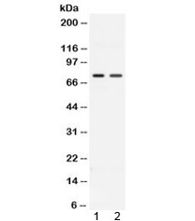 ACVR2 / ACVR2A Antibody - Western blot testing of 1) rat kidney and 2) human HeLa lysate with ACVR2A antibody at 0.5ug/ml. Predicted molecular weight ~58/70-80 kDa (unmodified/glycosylated).