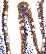 ACVRL1 Antibody - Immunohistochemical of paraffin-embedded H.small intestine section using ACVRL1 Antibody. Antibody was diluted at 1:25 dilution. A peroxidase-conjugated goat anti-rabbit IgG at 1:400 dilution was used as the secondary antibody, followed by DAB staining.