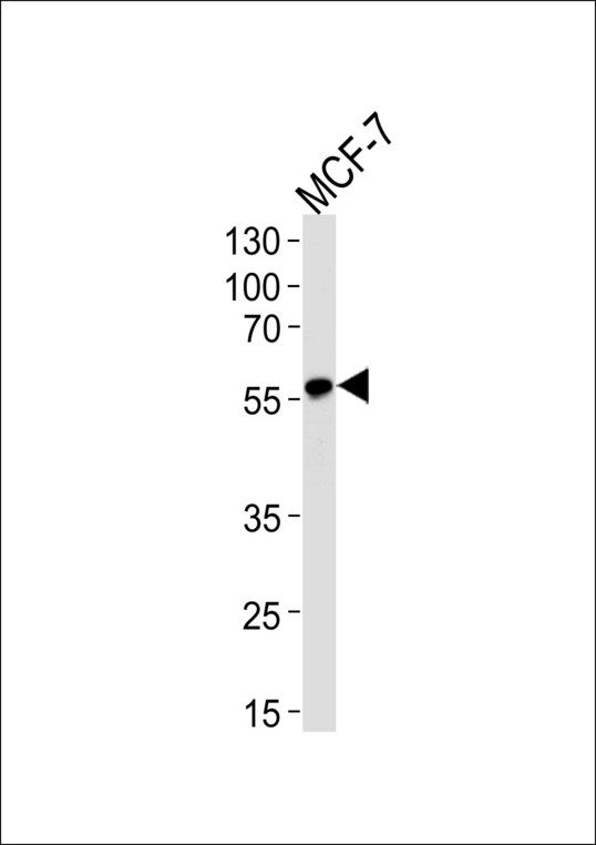 ACVRL1 Antibody - Western blot of lysate from MCF-7 cell line with ACVRL1 Antibody. Antibody was diluted at 1:1000. A goat anti-rabbit IgG H&L (HRP) at 1:5000 dilution was used as the secondary antibody. Lysate at 35 ug.