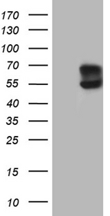 ACVRL1 Antibody - HEK293T cells were transfected with the pCMV6-ENTRY control. (Left lane) or pCMV6-ENTRY ACVRL1. (Right lane) cDNA for 48 hrs and lysed. Equivalent amounts of cell lysates. (5 ug per lane) were separated by SDS-PAGE and immunoblotted with anti-ACVRL1. (1:2000)