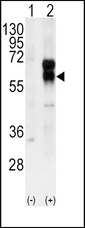 ACVRL1 Antibody - Western blot of ACVRL1 (arrow) using rabbit polyclonal ACVRL1 Antibody. 293 cell lysates (2 ug/lane) either nontransfected (Lane 1) or transiently transfected with the ACVRL1 gene (Lane 2) (Origene Technologies).