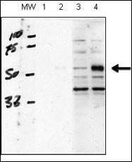ACVRL1 Antibody - human chondrocytes (C28/I2 cells), transfected with empty vector (lane 1, 3) or ACVRL1(lane 2, 4). RIPA lysis buffer, 20 ug/lane of protein, primary antibody dilution 1:1000, blocking solution is 5% milk in TBST (lane 1 and 2), 5% BSA in TBST (lane 3 and 4). Data courtesy of Kenneth Finnson, Montreal General Hospital.