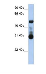 ACVRL1 Antibody - Jurkat cell lysate. Antibody concentration: 1.0 ug/ml. Gel concentration: 12%.  This image was taken for the unconjugated form of this product. Other forms have not been tested.