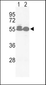 ACVRL1 Antibody - Western blot of hACVRL1-L489 in Jurkat(lane 1), HepG2(lane 2) cell line lysates (35 ug/lane). ACVRL1 (arrow) was detected using the purified antibody.