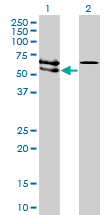 ACVRL1 Antibody - Western Blot analysis of ACVRL1 expression in transfected 293T cell line by ACVRL1 monoclonal antibody (M01), clone 5B1.Lane 1: ACVRL1 transfected lysate(56.124 KDa).Lane 2: Non-transfected lysate.