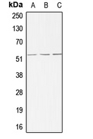 ACVRL1 Antibody - Western blot analysis of ALK1 expression in MCF7 (A); mouse liver (B); rat liver (C) whole cell lysates.