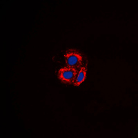 ACVRL1 Antibody - Immunofluorescent analysis of ALK1 staining in MCF7 cells. Formalin-fixed cells were permeabilized with 0.1% Triton X-100 in TBS for 5-10 minutes and blocked with 3% BSA-PBS for 30 minutes at room temperature. Cells were probed with the primary antibody in 3% BSA-PBS and incubated overnight at 4 C in a humidified chamber. Cells were washed with PBST and incubated with a DyLight 594-conjugated secondary antibody (red) in PBS at room temperature in the dark. DAPI was used to stain the cell nuclei (blue).