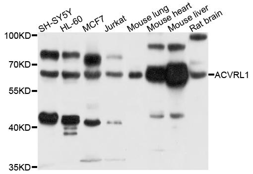 ACVRL1 Antibody - Western blot analysis of extracts of various cell lines, using ACVRL1 antibody at 1:1000 dilution. The secondary antibody used was an HRP Goat Anti-Rabbit IgG (H+L) at 1:10000 dilution. Lysates were loaded 25ug per lane and 3% nonfat dry milk in TBST was used for blocking. An ECL Kit was used for detection and the exposure time was 30s.
