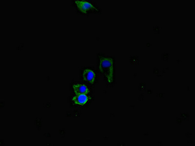 ACVRL1 Antibody - Immunofluorescent analysis of HepG2 cells diluted at 1:100 and Alexa Fluor 488-congugated AffiniPure Goat Anti-Rabbit IgG(H+L)