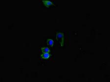 ACVRL1 Antibody - Immunofluorescent analysis of HepG2 cells diluted at 1:100 and Alexa Fluor 488-congugated AffiniPure Goat Anti-Rabbit IgG(H+L)