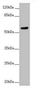 ACVRL1 Antibody - Western blot All Lanes :ACVRL1 antibody at 2 ug/ml+MCF7 whole cell lysate Secondary Goat polyclonal to rabbit at 1/10000 dilution Predicted band size: 56 kDa Observed band size: 56 kDa