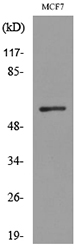 ACVRL1 Antibody - Western blot analysis of lysate from MCF7 cells, using ACVRL1 Antibody.
