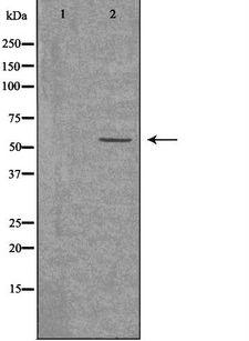 ACVRL1 Antibody - Western blot analysis of extracts of K562 cells using ACVL1 antibody. The lane on the left is treated with the antigen-specific peptide.