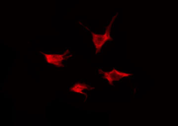 ACVRL1 Antibody - Staining HeLa cells by IF/ICC. The samples were fixed with PFA and permeabilized in 0.1% Triton X-100, then blocked in 10% serum for 45 min at 25°C. The primary antibody was diluted at 1:200 and incubated with the sample for 1 hour at 37°C. An Alexa Fluor 594 conjugated goat anti-rabbit IgG (H+L) Ab, diluted at 1/600, was used as the secondary antibody.