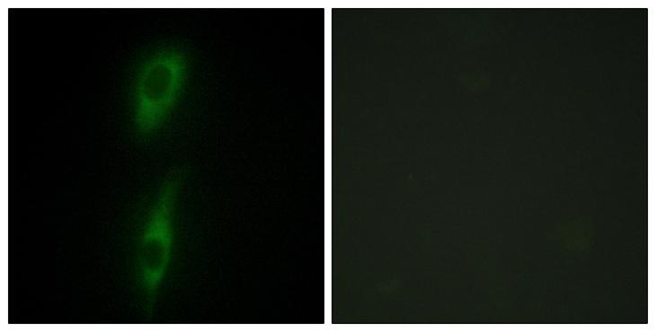 ACVRL1 Antibody - Peptide - + Immunofluorescence analysis of HeLa cells, using ACVL1 antibody.