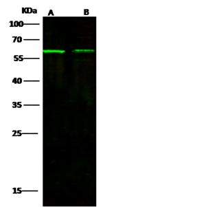 ACVRL1 Antibody - Anti-ACVRL1 rabbit polyclonal antibody at 1:500 dilution. Lane A: Jurkat Whole Cell Lysate. Lane B: K562 Whole Cell Lysate. Lysates/proteins at 30 ug per lane. Secondary: Goat Anti-Rabbit IgG H&L (Dylight 800) at 1/10000 dilution. Developed using the Odyssey technique. Performed under reducing conditions. Predicted band size: 56 kDa. Observed band size: 60 kDa.