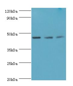 ACY1 / Aminoacylase 1 Antibody - Western blot. All lanes: ACY1 antibody at 4 ug/ml. Lane 1: K562 whole cell lysate. Lane 2: HepG2 whole cell lysate. Lane 3: Mouse kidney tissue. Secondary antibody: Goat polyclonal to rabbit at 1:10000 dilution. Predicted band size: 46 kDa. Observed band size: 46 kDa.