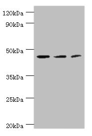 ACY1 / Aminoacylase 1 Antibody - Western blot All lanes: ACY1 antibody at 4µg/ml Lane 1: K562 whole cell lysate Lane 2: HepG2 whole cell lysate Lane 3: Mouse kidney tissue Secondary Goat polyclonal to rabbit IgG at 1/10000 dilution Predicted band size: 46, 38, 39, 43 kDa Observed band size: 46 kDa