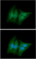 ACY1 / Aminoacylase 1 Antibody - ICC/IF analysis of ACY1 in HeLa cells line, stained with DAPI (Blue) for nucleus staining and monoclonal anti-human ACY1 antibody (1:100) with goat anti-mouse IgG-Alexa fluor 488 conjugate (Green).