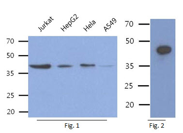 ACY1 / Aminoacylase 1 Antibody - Fig 1.: The cell lysates of Jurkat, HepG2, Hela, A549 (40ug) were resolved by SDS-PAGE, transferred to PVDF membrane and probed with anti-human ACY1 antibody (1:500). Proteins were visualized using a goat anti-mouse secondary antibody conjugated to HRP and an ECL detection system. Fig. 2: The Recombinant Human ACY1 (50ng) was resolved by SDS-PAGE, transferred to PVDF membrane and probed with anti-human ACY1 antibody (1:1000). Proteins were visualized using a goat anti-mouse secondary antibody conjugated to HRP and an ECL detection system.