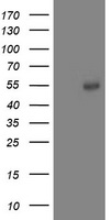 ACY1 / Aminoacylase 1 Antibody - HEK293T cells were transfected with the pCMV6-ENTRY control (Left lane) or pCMV6-ENTRY ACY1 (Right lane) cDNA for 48 hrs and lysed. Equivalent amounts of cell lysates (5 ug per lane) were separated by SDS-PAGE and immunoblotted with anti-ACY1.