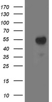 ACY1 / Aminoacylase 1 Antibody - HEK293T cells were transfected with the pCMV6-ENTRY control (Left lane) or pCMV6-ENTRY ACY1 (Right lane) cDNA for 48 hrs and lysed. Equivalent amounts of cell lysates (5 ug per lane) were separated by SDS-PAGE and immunoblotted with anti-ACY1.
