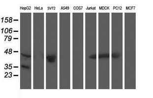 ACY1 / Aminoacylase 1 Antibody - Western blot of extracts (35ug) from 9 different cell lines by using anti-ACY1 monoclonal antibody.