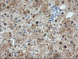 ACY1 / Aminoacylase 1 Antibody - IHC of paraffin-embedded Human liver tissue using anti-ACY1 mouse monoclonal antibody. (Heat-induced epitope retrieval by 10mM citric buffer, pH6.0, 100C for 10min).