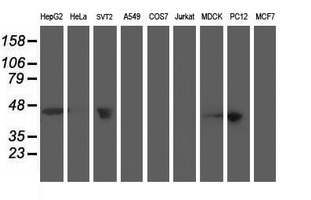 ACY1 / Aminoacylase 1 Antibody - Western blot of extracts (35 ug) from 9 different cell lines by using anti-ACY1 monoclonal antibody.
