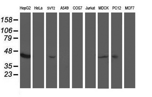 ACY1 / Aminoacylase 1 Antibody - Western blot of extracts (35 ug) from 9 different cell lines by using anti-ACY1 monoclonal antibody.