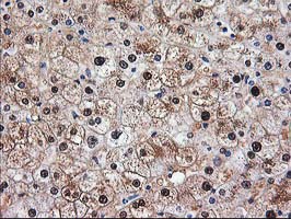 ACY1 / Aminoacylase 1 Antibody - IHC of paraffin-embedded Human liver tissue using anti-ACY1 mouse monoclonal antibody.