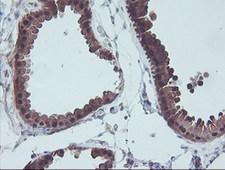 ACY1 / Aminoacylase 1 Antibody - IHC of paraffin-embedded Human breast tissue using anti-ACY1 mouse monoclonal antibody.