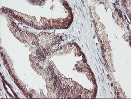 ACY1 / Aminoacylase 1 Antibody - IHC of paraffin-embedded Human prostate tissue using anti-ACY1 mouse monoclonal antibody.