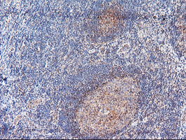 ACY1 / Aminoacylase 1 Antibody - IHC of paraffin-embedded Human tonsil using anti-ACY1 mouse monoclonal antibody.