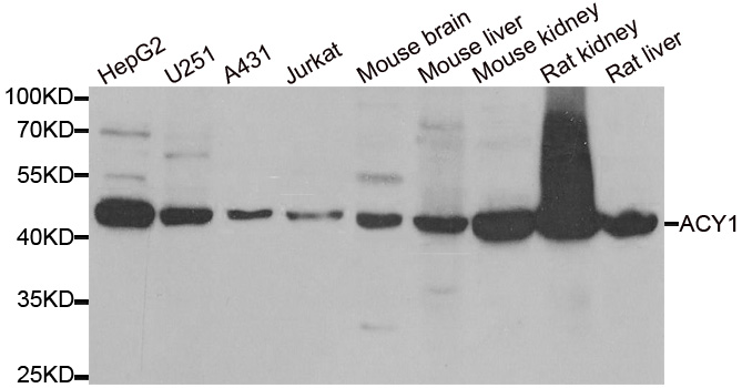 ACY1 / Aminoacylase 1 Antibody - Western blot analysis of extracts of various cell lines.