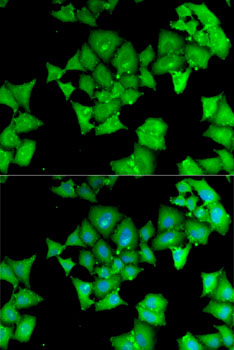 ACY1 / Aminoacylase 1 Antibody - Immunofluorescence analysis of MCF7 cells using ACY1 antibody. Blue: DAPI for nuclear staining.