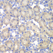 ACY1 / Aminoacylase 1 Antibody - Immunohistochemistry of paraffin-embedded rat kidney using ACY1 antibody at dilution of 1:100 (40x lens).