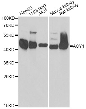 ACY1 / Aminoacylase 1 Antibody - Western blot analysis of extracts of various cell lines, using ACY1 antibody at 1:1000 dilution. The secondary antibody used was an HRP Goat Anti-Rabbit IgG (H+L) at 1:10000 dilution. Lysates were loaded 25ug per lane and 3% nonfat dry milk in TBST was used for blocking.
