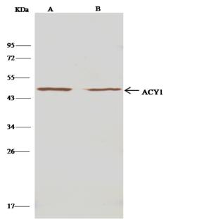 ACY1 / Aminoacylase 1 Antibody - Mouse ACY1 was immunoprecipitated using: Lane A: 0.5 mg K562 Whole Cell Lysate. Lane B: 0.5 mg HepG2 Whole Cell Lysate. 1 uL anti-Mouse ACY1 rabbit polyclonal antibody and 15 ul of 50% Protein G agarose. Primary antibody: Anti-Mouse ACY1 rabbit polyclonal antibody, at 1:500 dilution. Secondary antibody: Clean-Blot IP Detection Reagent (HRP) at 1:500 dilution. Developed using the DAB staining technique. Performed under reducing conditions. Predicted band size: 46 kDa. Observed band size: 46 kDa.
