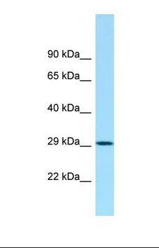 ACY3 Antibody - Western blot of Human U937. HCBP1 antibody dilution 1.0 ug/ml.  This image was taken for the unconjugated form of this product. Other forms have not been tested.
