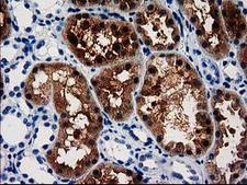 ACY3 Antibody - IHC of paraffin-embedded Human Kidney tissue using anti-ACY3 mouse monoclonal antibody. (Heat-induced epitope retrieval by 10mM citric buffer, pH6.0, 100C for 10min).