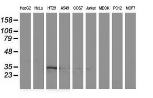 ACY3 Antibody - Western blot of extracts (35ug) from 9 different cell lines by using anti-ACY3 monoclonal antibody (HepG2: human; HeLa: human; SVT2: mouse; A549: human; COS7: monkey; Jurkat: human; MDCK: canine; PC12: rat; MCF7: human).