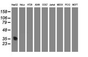 ACY3 Antibody - Western blot of extracts (35 ug) from 9 different cell lines by using anti-ACY3 monoclonal antibody (HepG2: human; HeLa: human; SVT2: mouse; A549: human; COS7: monkey; Jurkat: human; MDCK: canine; PC12: rat; MCF7: human).