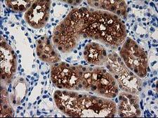 ACY3 Antibody - IHC of paraffin-embedded Human Kidney tissue using anti-ACY3 mouse monoclonal antibody.