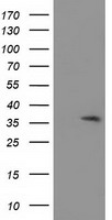 ACY3 Antibody - HEK293T cells were transfected with the pCMV6-ENTRY control (Left lane) or pCMV6-ENTRY ACY3 (Right lane) cDNA for 48 hrs and lysed. Equivalent amounts of cell lysates (5 ug per lane) were separated by SDS-PAGE and immunoblotted with anti-ACY3.